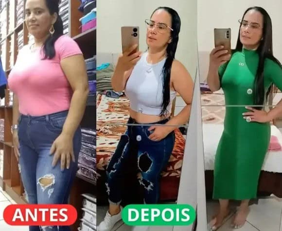 Antes e Depois de Fernanda